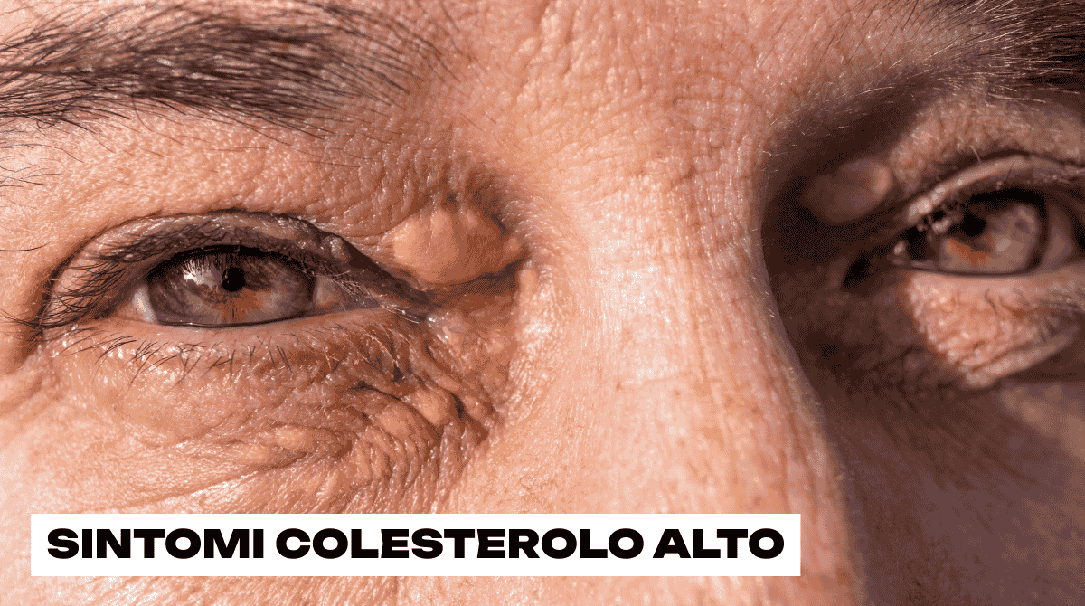 Colesterolo alto negli occhi: 5 segnali nascosti che possono avvisarti troppo tardi