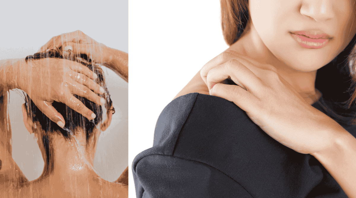 Prurito dopo la doccia: perché succede davvero e come farlo sparire per sempre